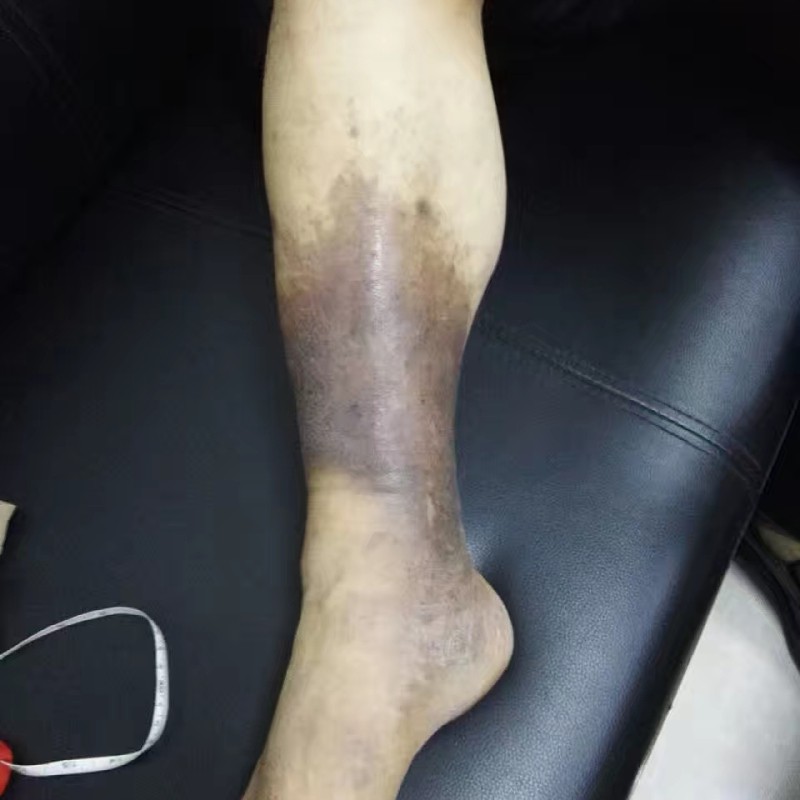 1602745609194930.jpg